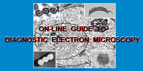 On-line Guide to Diagnostic Electron Microscopy